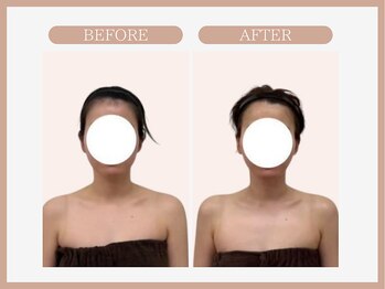 アコガレコガオ 仙台店/