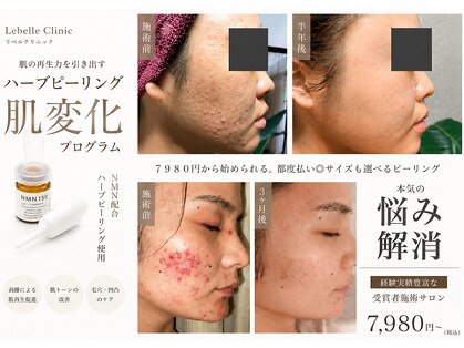 リベル 名古屋(Lebelle:)の写真