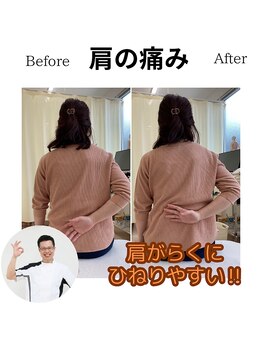 三条かがやき整体院/肩の痛み改善