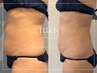 初回体験【ボディ人気No.1☆】新脂肪燃焼剤10ml導入×痩身マッサージ