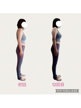 フォーシー(4C)/Before/After