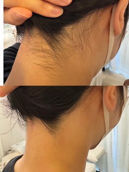 さとう美容整体 川崎本店/うなじシェービング