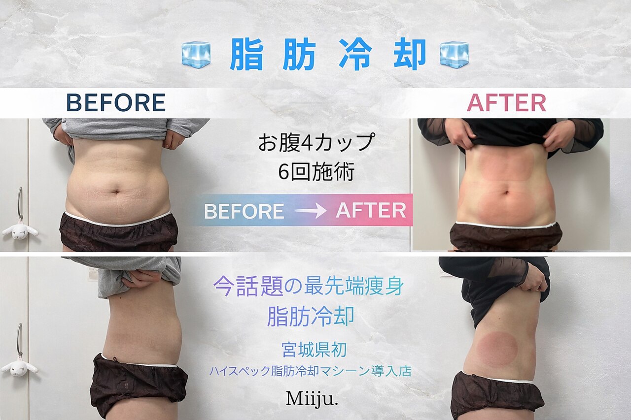 ミージュ(Miiju.)｜ホットペッパービューティー