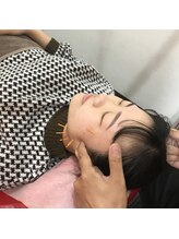 よつば鍼灸整骨院 春日院/美容鍼