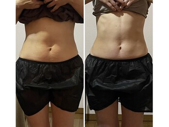 しあわせ腸研究所/before & after