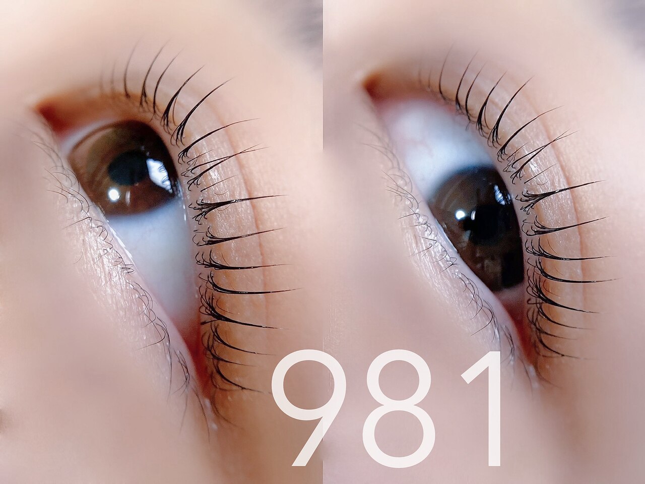 981｜ホットペッパービューティー
