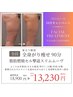【10月限定】全身がり痩せスリムムーヴ 90分 ¥18900 → 30%OFF ¥13230