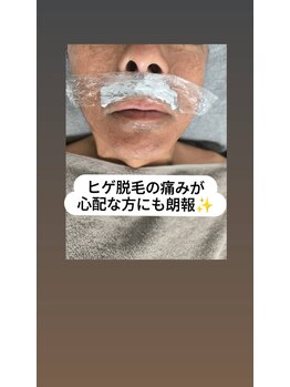 フォーグッド(forgood)/ヒゲ脱毛の痛みが心配な方に朗報