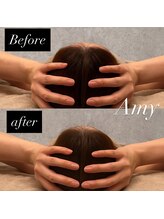 エイミー(Amy)/オススメ［頭蓋骨矯正］