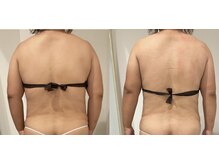 エンフィール(&.Feel)