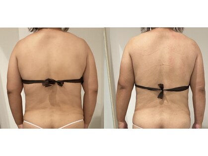 エンフィール(&.Feel)の写真