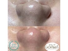 キレイノココロミ(きれいのCoCoRomi)/