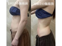 介正鍼灸整骨院 整体院 エフコープ大野城店/痩身エステ＊ラジオ波／キャビ