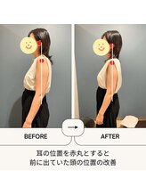 リロット(relot)/姿勢不良による頭の位置の改善