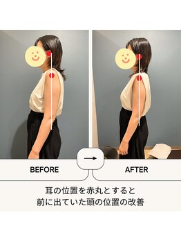 リロット(relot)/姿勢不良による頭の位置の改善