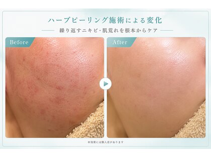 ルアナ 柏本店(LUANA)の写真