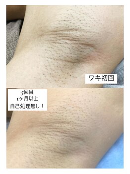 リル(Lil)/5回目で自己処理要らずに♪