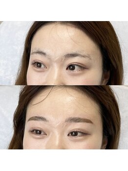 アイリー(IRIE)/ハリウッドブロウリフト