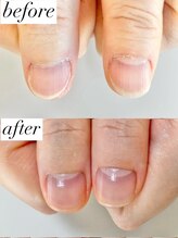 ニコワイズネイル(Nico Y's Nail)/【自爪育成コース】