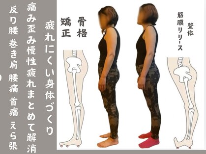 ガロシェ(galocher)の写真