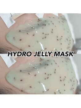 レディエント 北浦和店(Radiant)/額WAX＋HYDRO JELLY MASK
