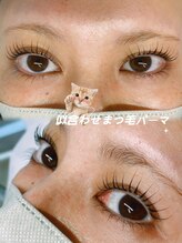 エイティピカル(Atypical)/絡まる目尻のお悩み解決デザイン