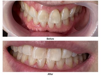 コアルナ センター北店(Coalna)/歯科提携・セルフホワイトニング