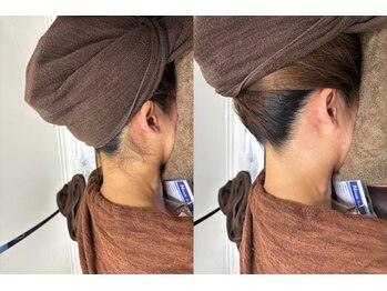 ミース 宮崎店/うなじ脱毛でこんなに変わる後姿