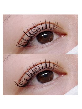 ブライズ(BRISE)/バインドロック