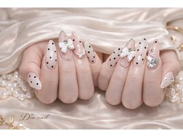 持ち込み/フィルイン/パラジェル