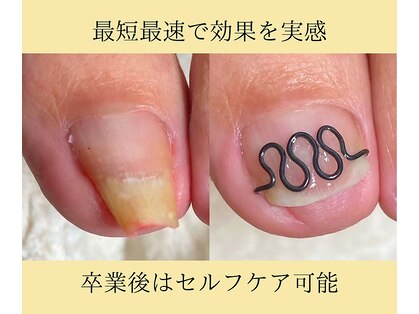 フレッシュフット(FreshFoot)の写真