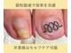 フレッシュフット(FreshFoot)の写真