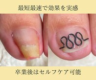 フレッシュフット(FreshFoot)