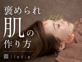 ルディア 堂島店(ledia)/大阪美容鍼lediaルディア堂島店