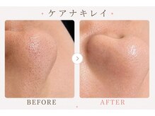パールプラス 伊勢店(Pearl plus)/毛穴の黒ずみケア♪