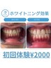 人気No.１白さ即実感ホワイトニング◎プレミアホワイトニング◇￥4000→2000