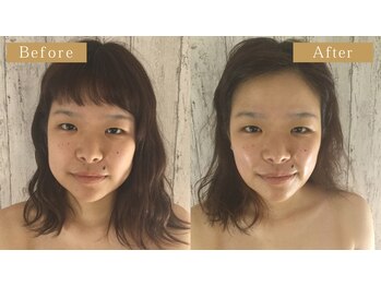 グレースフィオーレ 南越谷店(gracefiore)/リフトアップ｜小顔｜たるみ改善