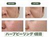 【小顔/肌質改善】ご褒美フェイシャル＋ハーブピーリング 
