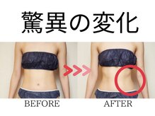 スズ(SUZU)の雰囲気（最新痩身＊体質別パーソナル痩身＊結果重視＊満足度NO1）