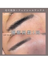 ベルミー(Bellmi)/毛穴洗浄＋フェイシャルワックス