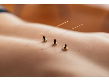 きずな鍼灸整骨院 光の森院/鍼灸