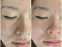 エムズ(M's)/Before /After