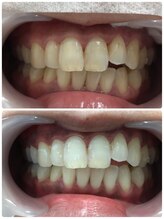 ドクターモック(Dr.MOC)/ＢＥＦＯＲＥ→ＡＦＴＥＲ
