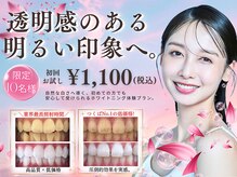 ホワイトニングショップ つくば店(WHITENING SHOP)