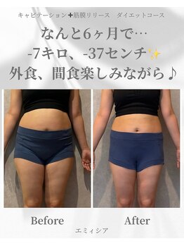 エミィシア(Emisia)/