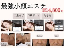 ルネ(Rune)の雰囲気（【大人気】韓国肌管理 二重あご　フェイスライン　の引締めケア）