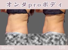 レッド(RED)/マイクロウェーブpro