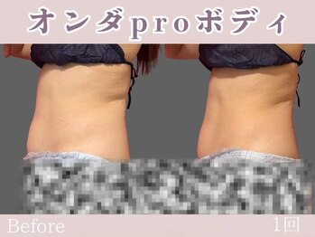 レッド(RED)/マイクロウェーブpro
