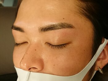 ミキ(MIKI)/【施術写真】