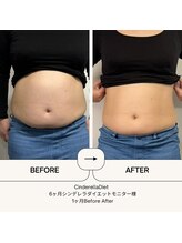 オーシャン整骨院(OCEAN整骨院)/ダイエット６ヶ月コース